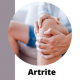 Artrite