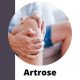 Artrose