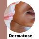 Dermatose